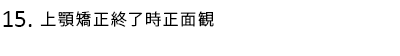 上顎矯正終了時正面観