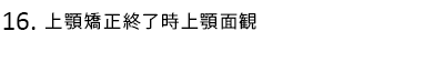 上顎矯正終了時上顎面観