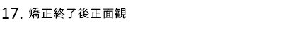 矯正終了後正面観