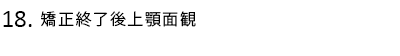 矯正終了後上顎面観