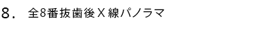 全8番抜歯後X線パノラマ