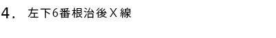 左下6番根治後X線