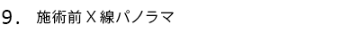 施術前X線パノラマ