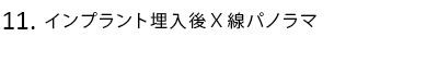 インプラント埋入後X線パノラマ