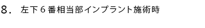 左下6番相当部インプラント施術時