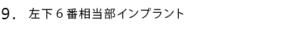 左下6番相当部インプラント