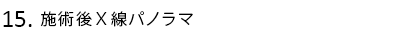 施術後X線パノラマ