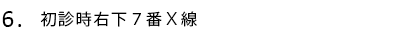 初診時右下7番X線