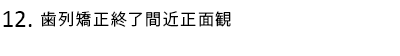 歯列矯正終了間近正面観