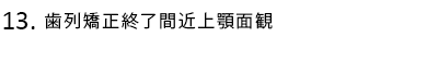 歯列矯正終了間近上顎面観