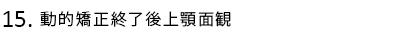 動的矯正終了後上顎面観