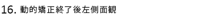 動的矯正終了後左側面観