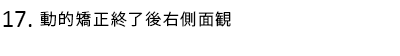 動的矯正終了後右側面観