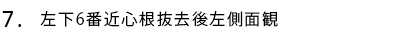 左下6番近心根抜去後左側面観