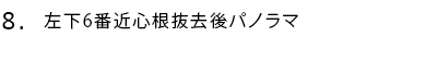 左下6番近心根抜去後パノラマ