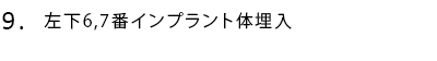 左下6,7番インプラント体埋入